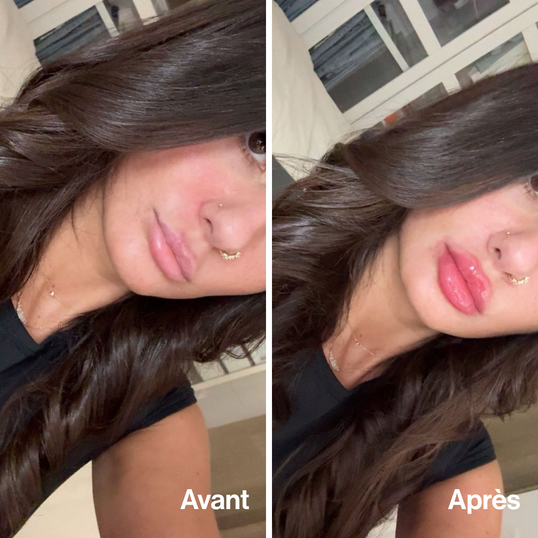 Extreme Lip Volume — Ultra-Plump and Sculpted Lips