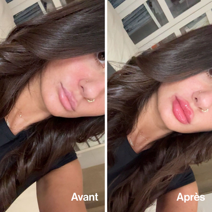 Extreme Lip Volume — Ultra-Plump and Sculpted Lips
